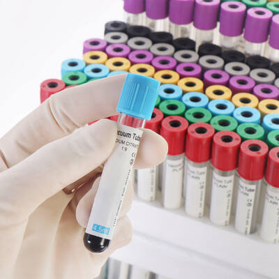 comprar Tubos de sangue EDTA a vácuo para análise completa do sangue (CBC) fabricação em linha