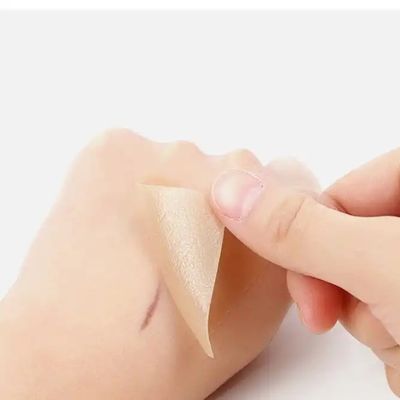 Bom preço Folhas de silicone cicatrizes, fita, tiras - Queloide de cura, cesariana, abdominoplastia - Tratamento de cicatrizes cirúrgicas on-line